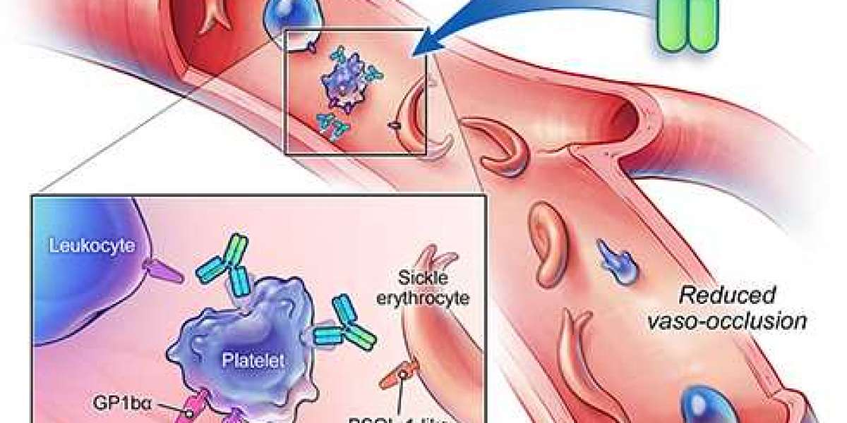 Vaso Occlusive Crisis Drug Pipeline Analysis, Current Landscape, Trends, Future Directions, share & Market Insights 